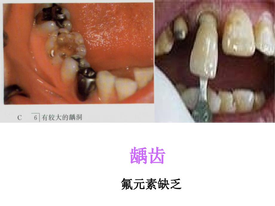 ((人教版))[[初三化学课件]]初三化学《化学元素与人体健康》PPT课件_第3页