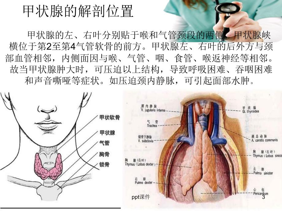 甲状腺癌术后护理ppt课件_第3页