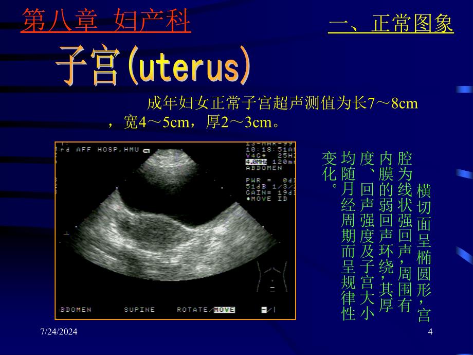 上海交大妇产超声_第4页