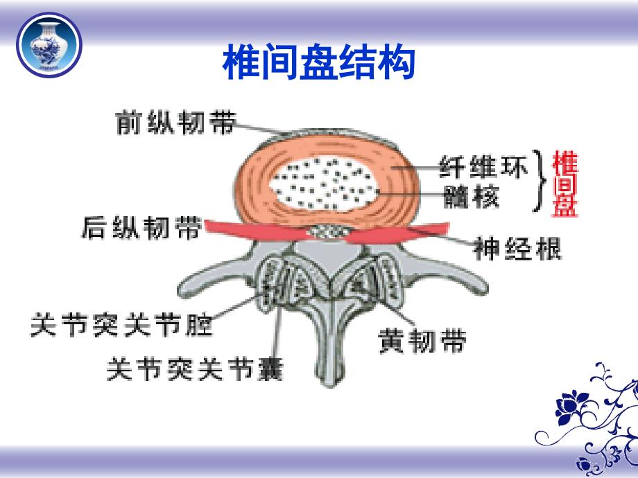 腰椎间盘突出症的护理程亚娟.PPT_第4页