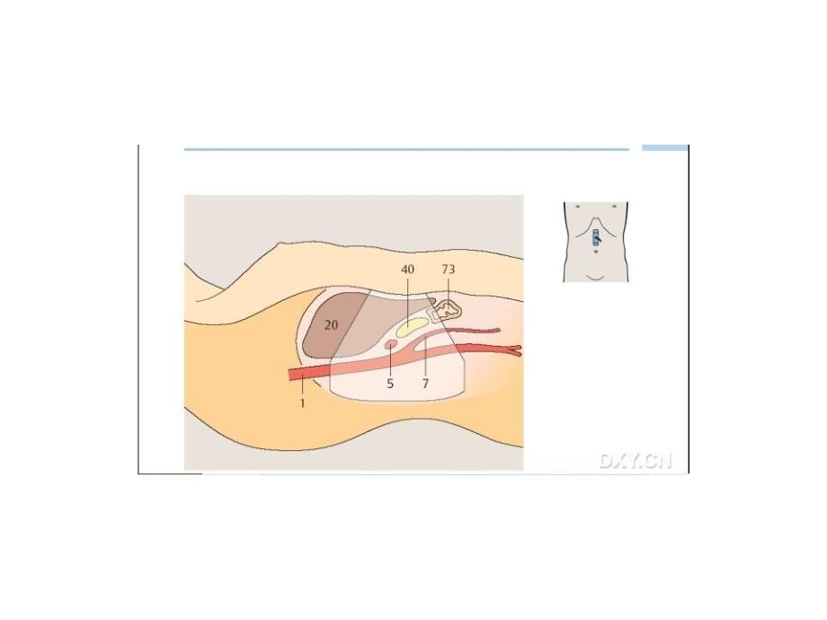 超声腹部检查操作法_第3页