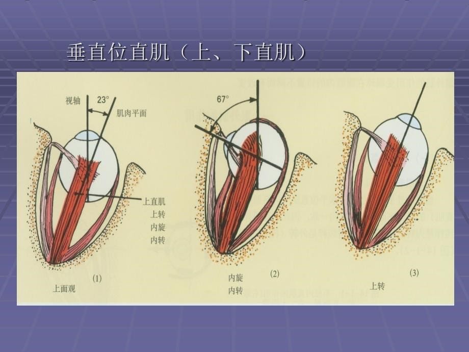 眼外肌病和弱视_第5页