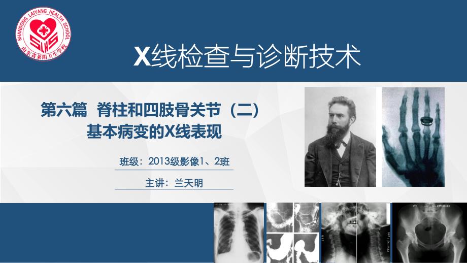 X线检查与诊断技术脊柱和四肢骨关节基本病变的X线表现行业荟萃_第1页