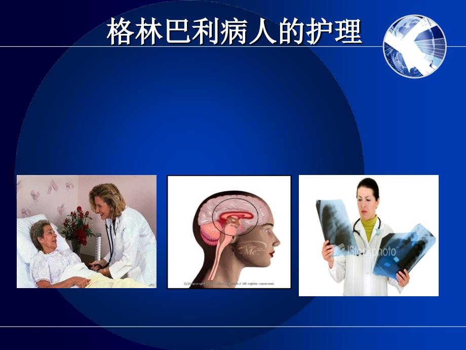 格林巴利综合症_第4页