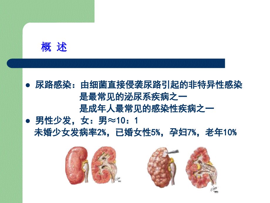 尿路感染课件_第3页