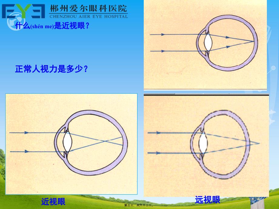 屈光不正矫正方法课件_第3页