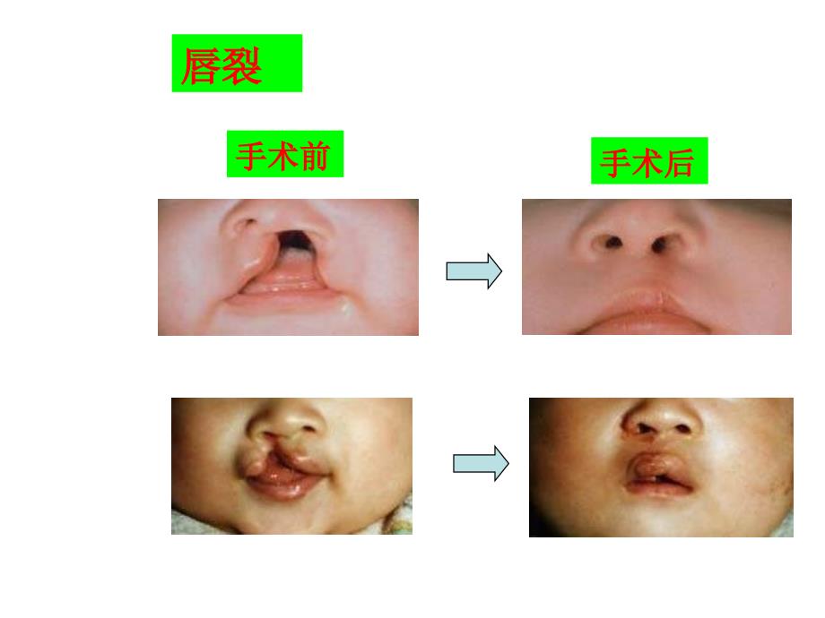 八年级生物遗传病与健康.ppt_第2页