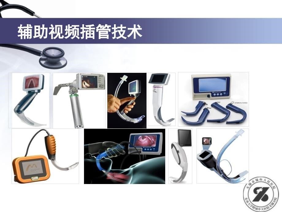 可视双腔支气管插管术在单肺通气中的应用2017_第5页