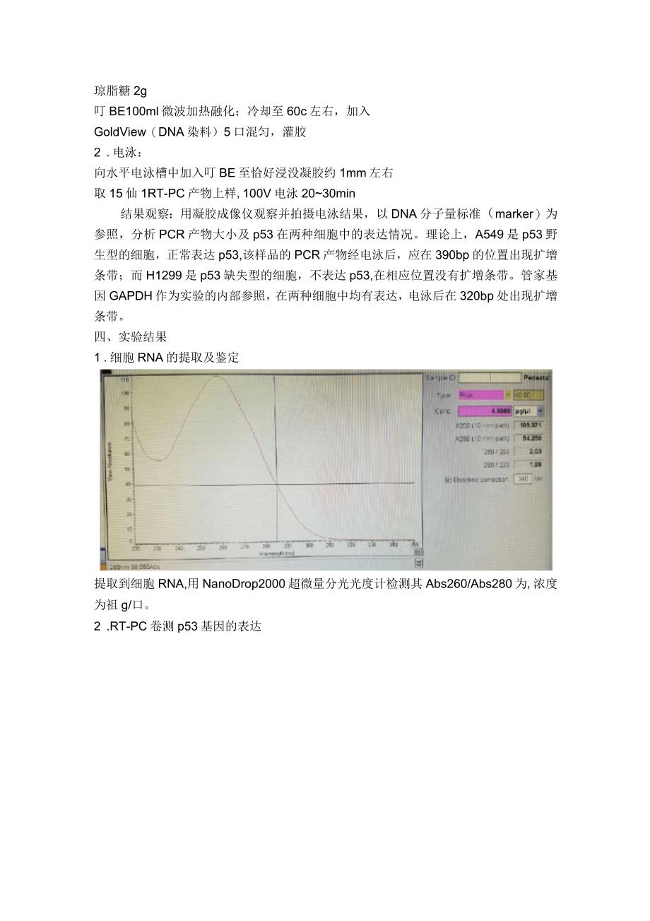 细胞RNA的提取及鉴定、RT-PCR检测p53基因的表达_第3页