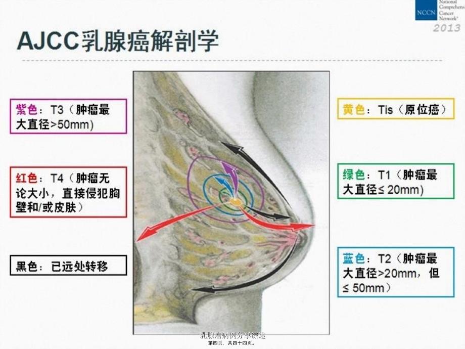 乳腺癌病例分享综述课件_第4页