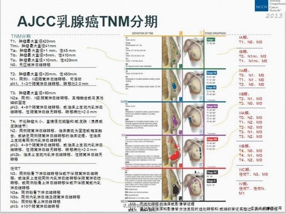 乳腺癌病例分享综述课件_第5页