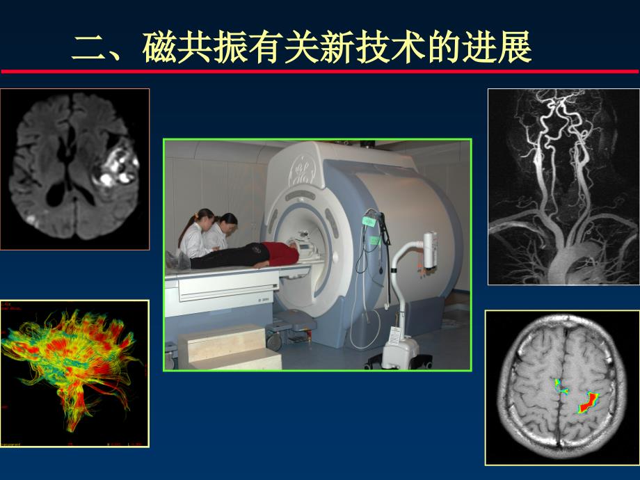 mr进展与解剖ppt课件_第1页