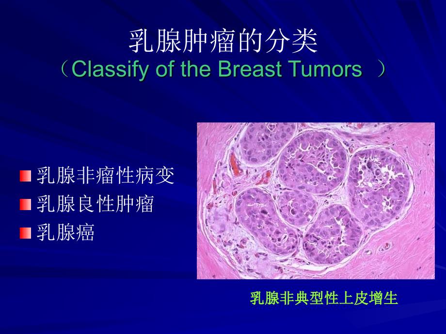 医学课件：乳腺肿瘤_第1页