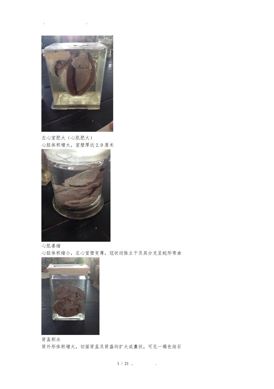 病理学实验大体标本图片和描述_第1页