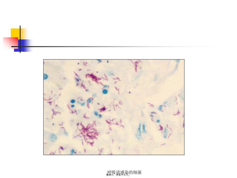 呼吸道感染的细菌课件_第4页