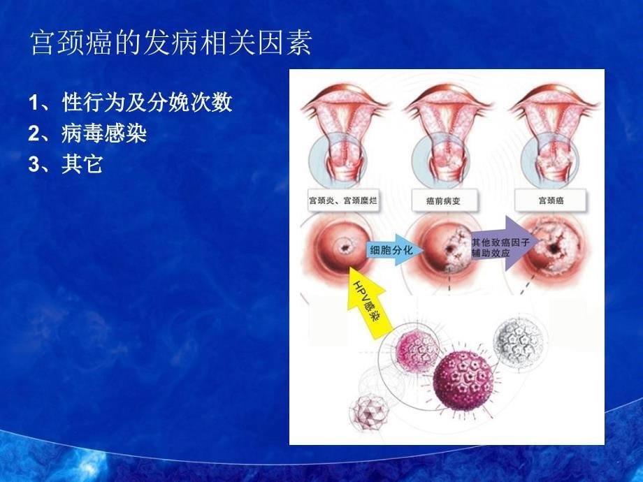 病理宫颈肿瘤_第5页