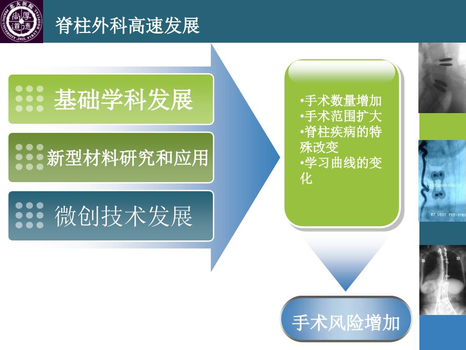 腰椎手术的并发症365骨科网_第2页