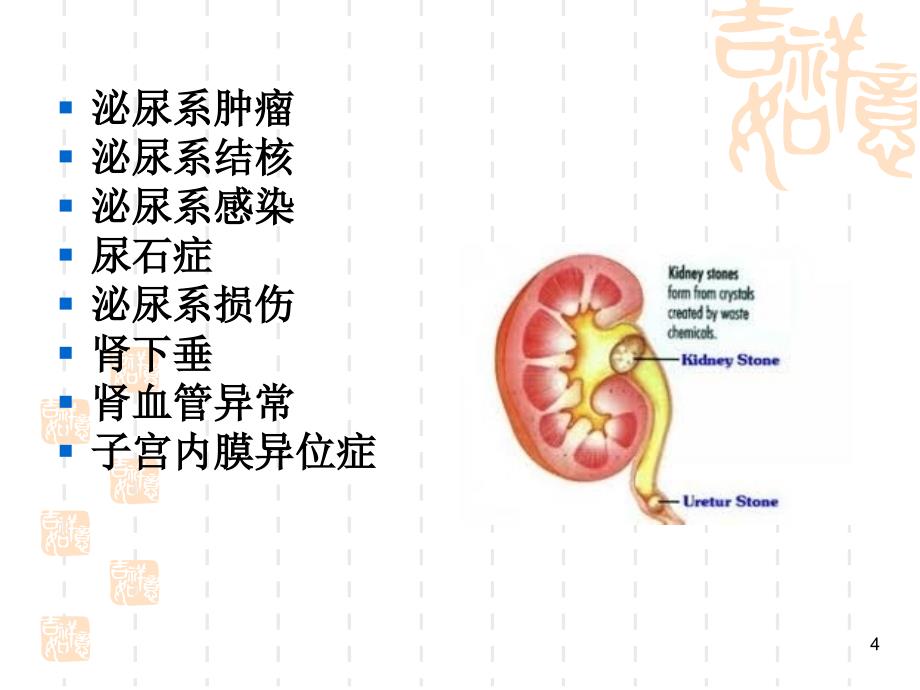 医学PPT课件血尿的鉴别诊断_第4页