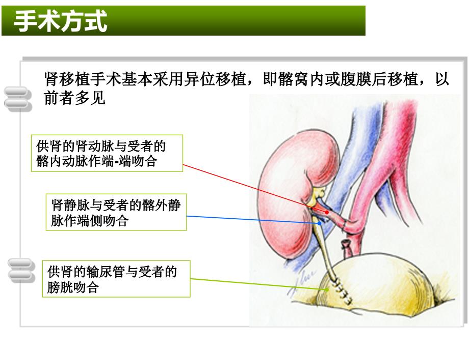 肾移植病人的护理课件_第4页