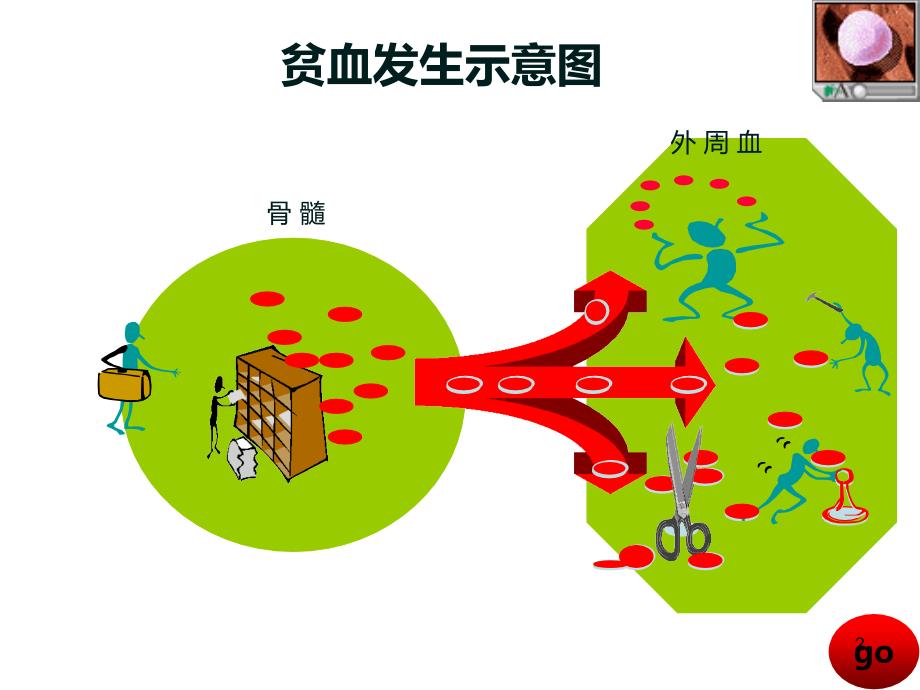 贫血及缺铁性贫血PPT课件_第2页