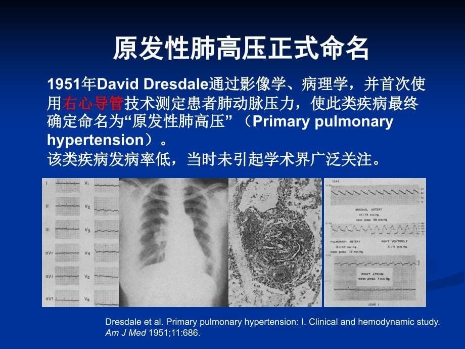 肺动脉高压的诊治进展_第5页