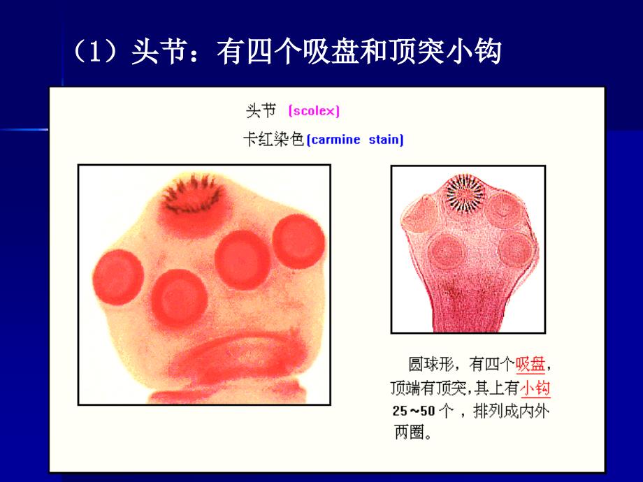 寄生虫-猪带绦虫_第3页