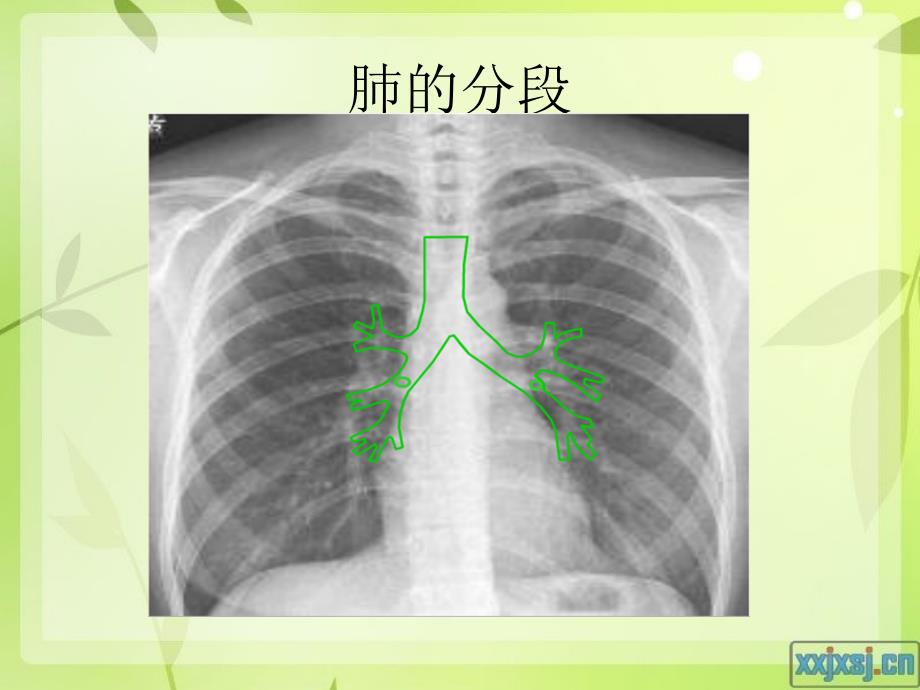 肺的分段与肺与纵膈的淋巴结分组 ppt课件_第4页