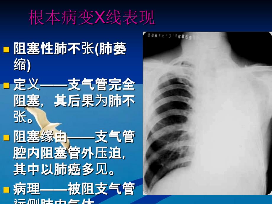 重庆益民医院呼吸系统ppt课件_第3页