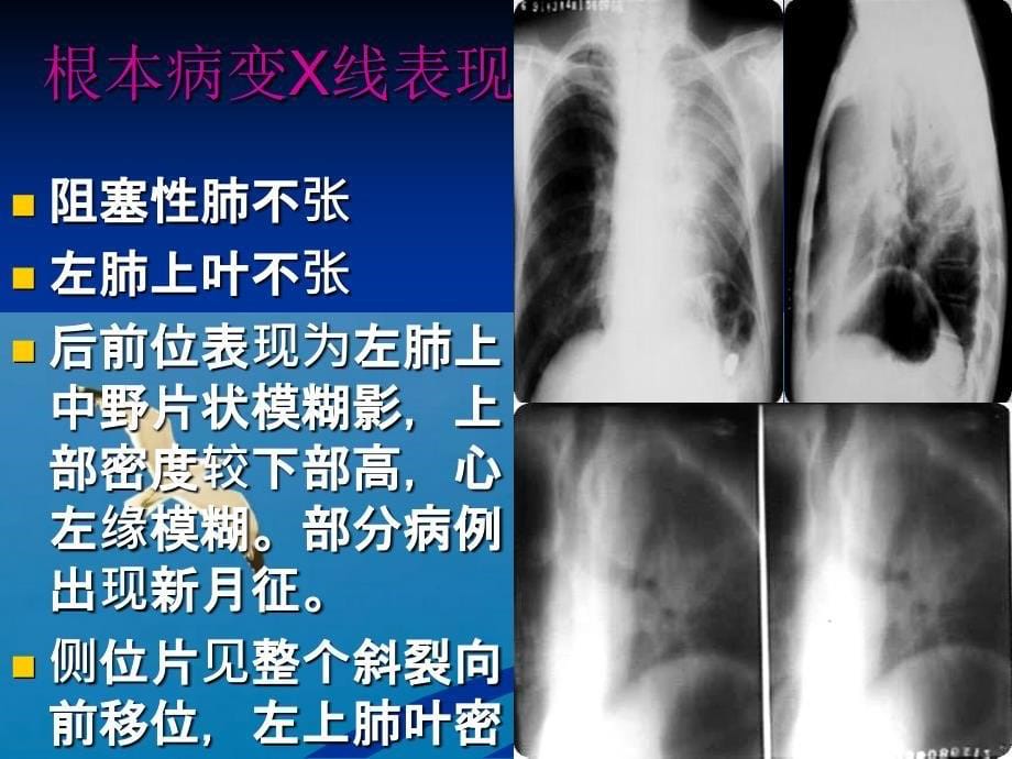 重庆益民医院呼吸系统ppt课件_第5页