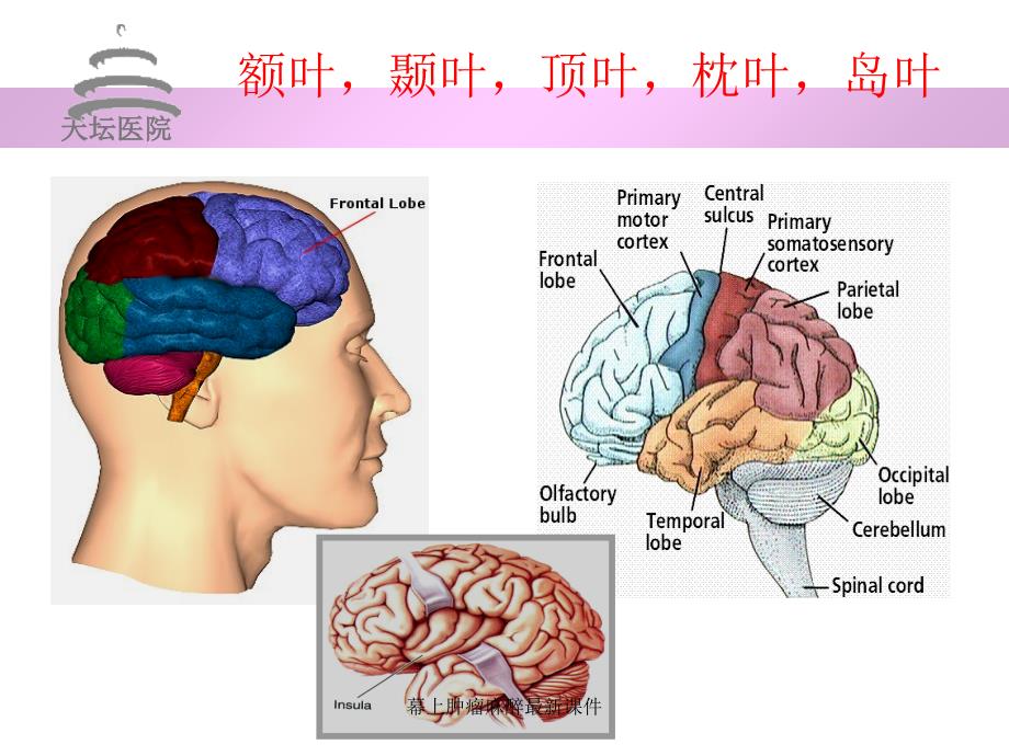 幕上肿瘤麻醉最新课件_第4页