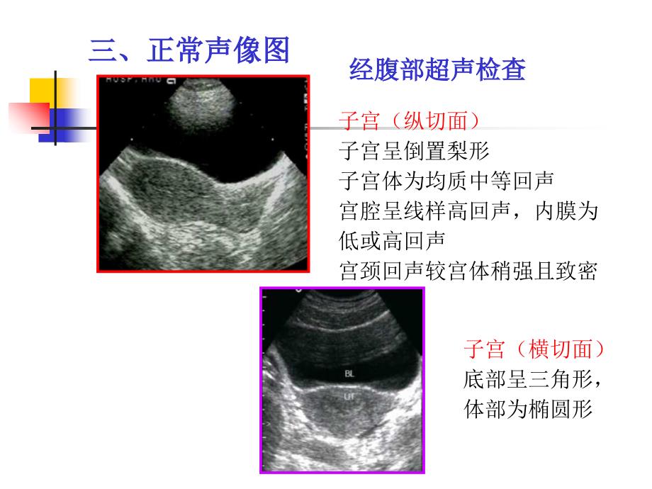 最新安医大本硕 妇产科疾病的超声诊断2PPT文档_第1页