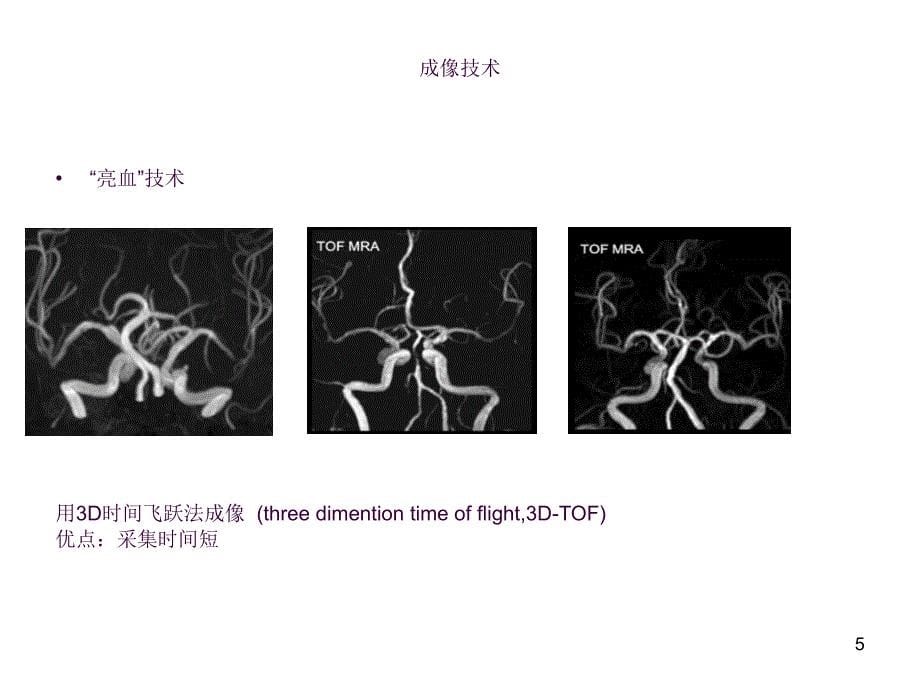 颅内动脉斑块高分辨成像ppt课件_第5页