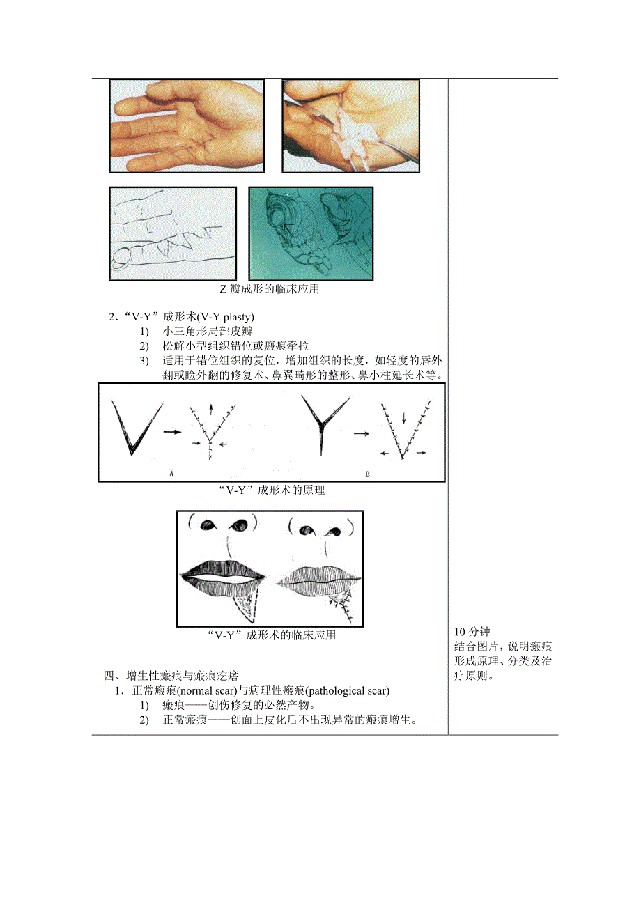 教案整形外科学Word版_第4页