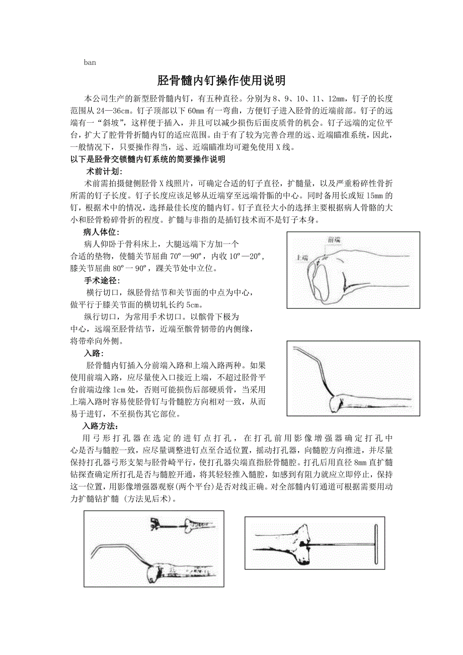 胫骨髓内钉操作使用说明_第1页