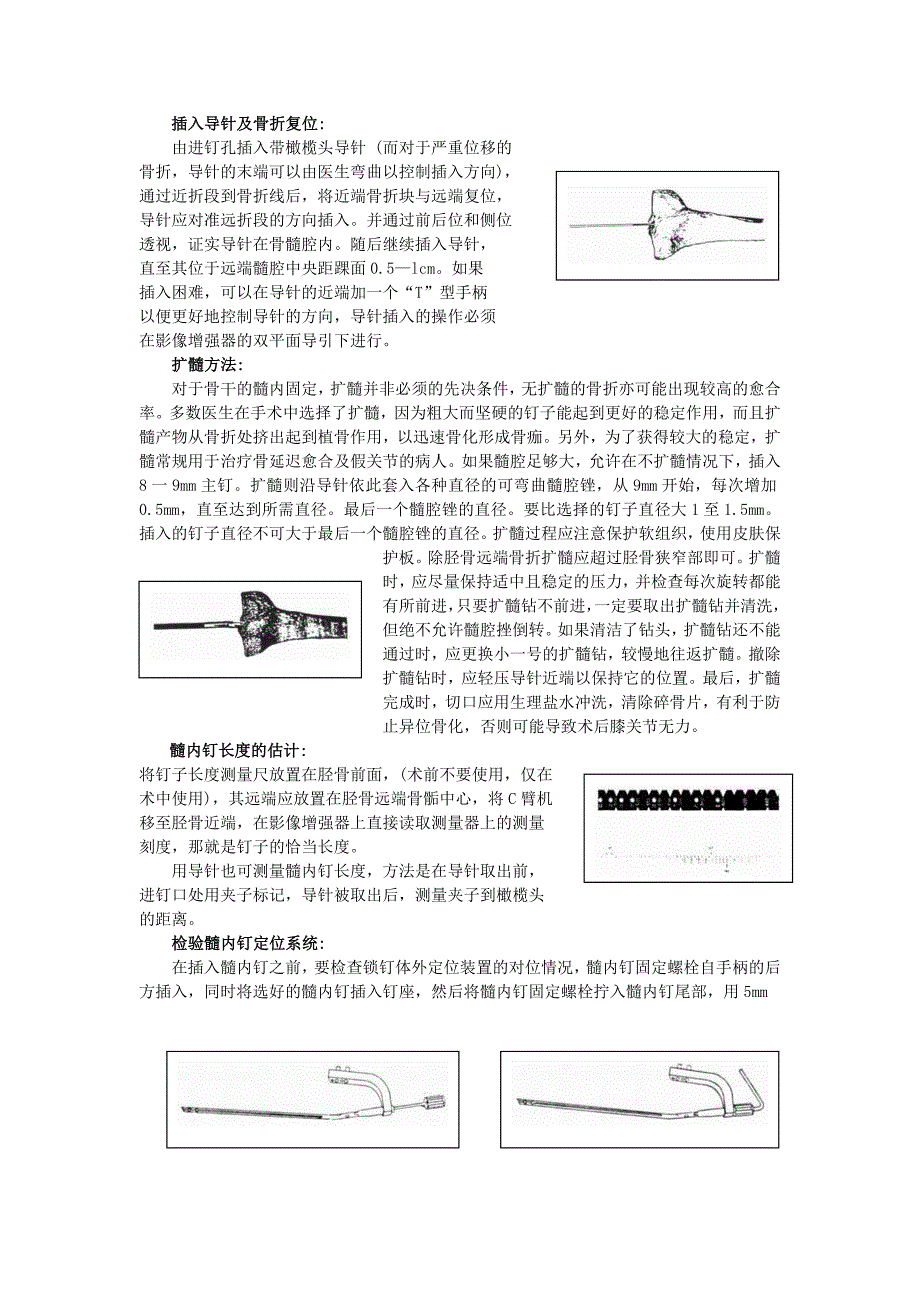 胫骨髓内钉操作使用说明_第2页