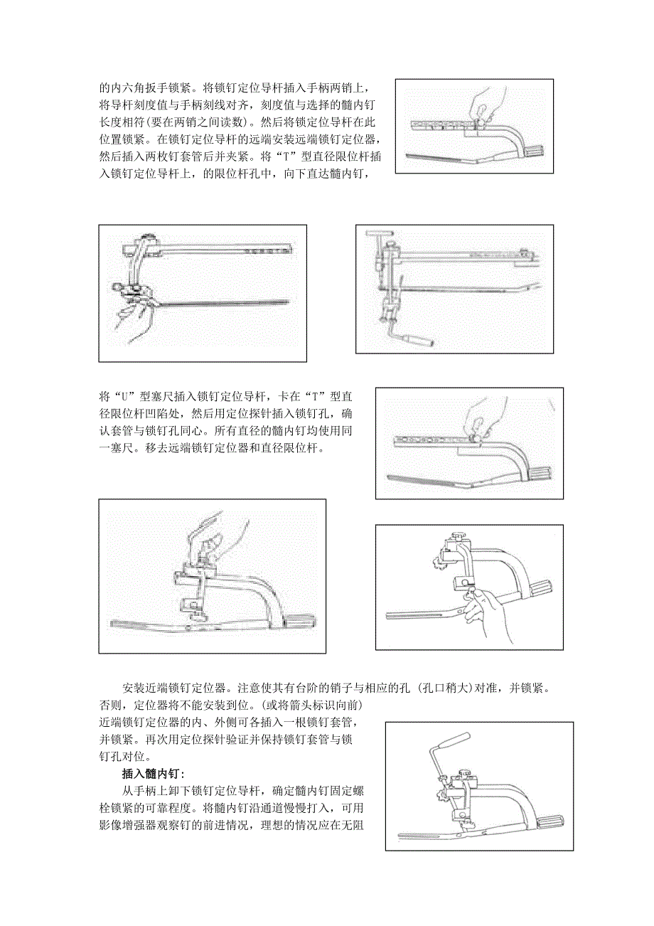 胫骨髓内钉操作使用说明_第3页