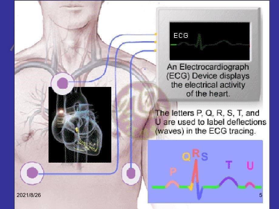 心电图的形成原理-课件PPT_第5页