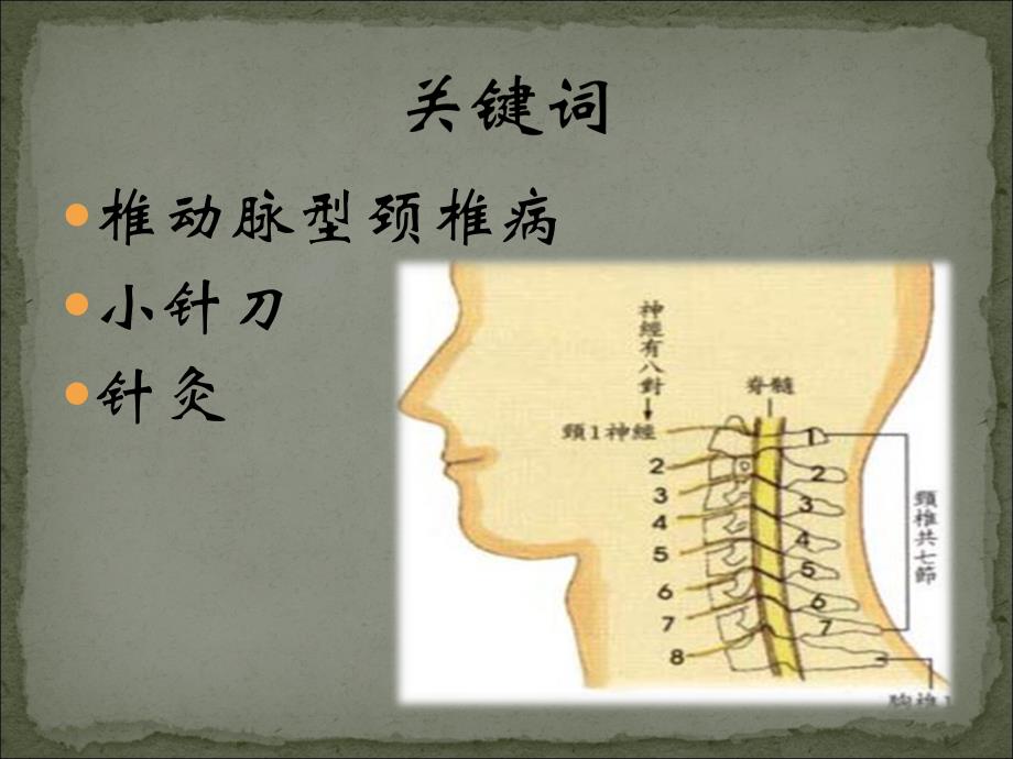 小针刀治疗椎动脉型颈椎病_第4页