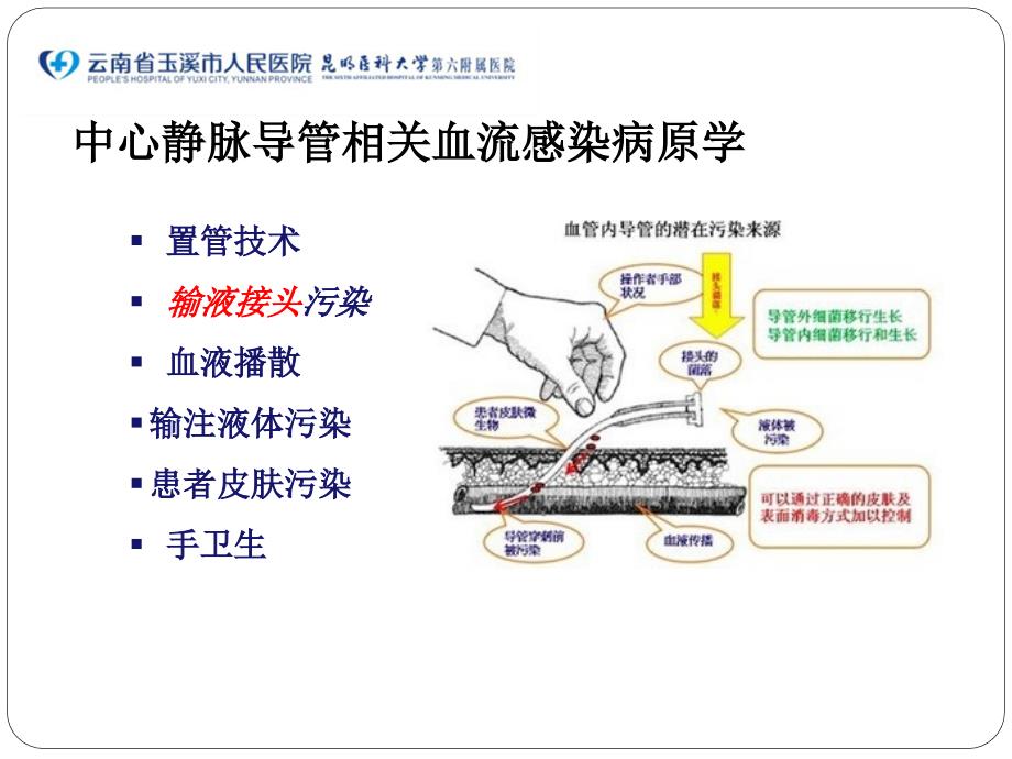 输液接头的日常维护与更换_第3页