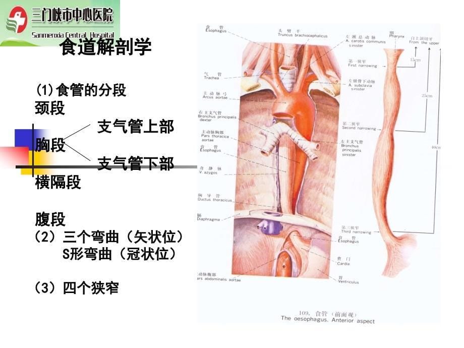 食道异物的诊断与治疗_第5页