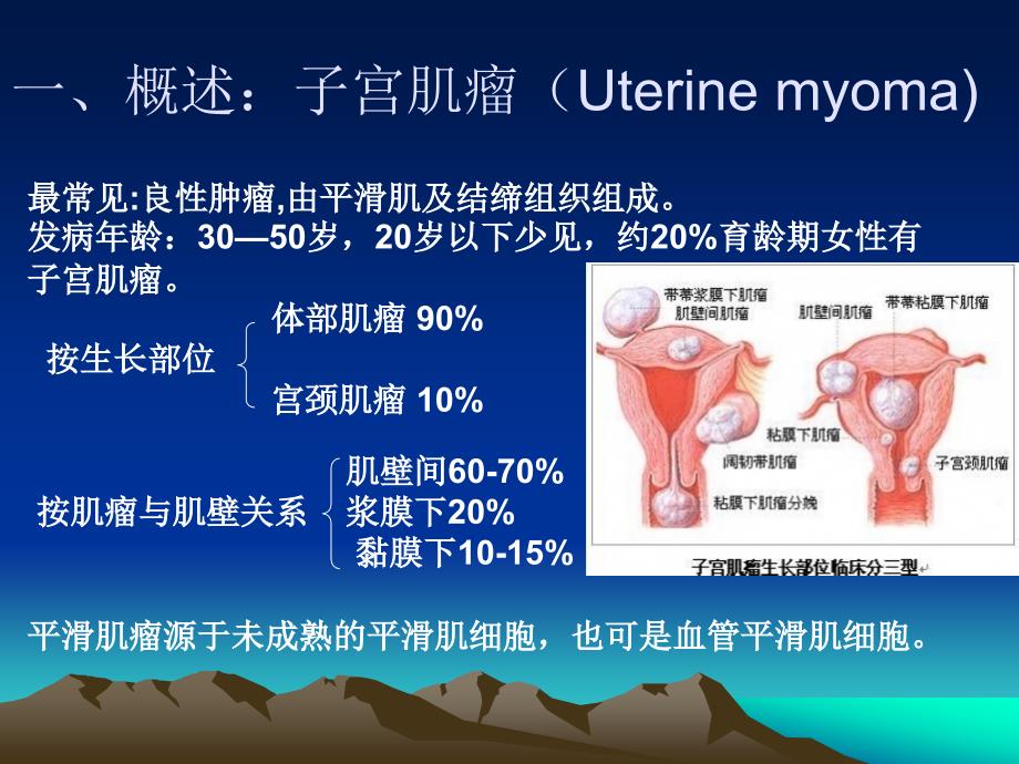 金艳子宫肌瘤_第2页