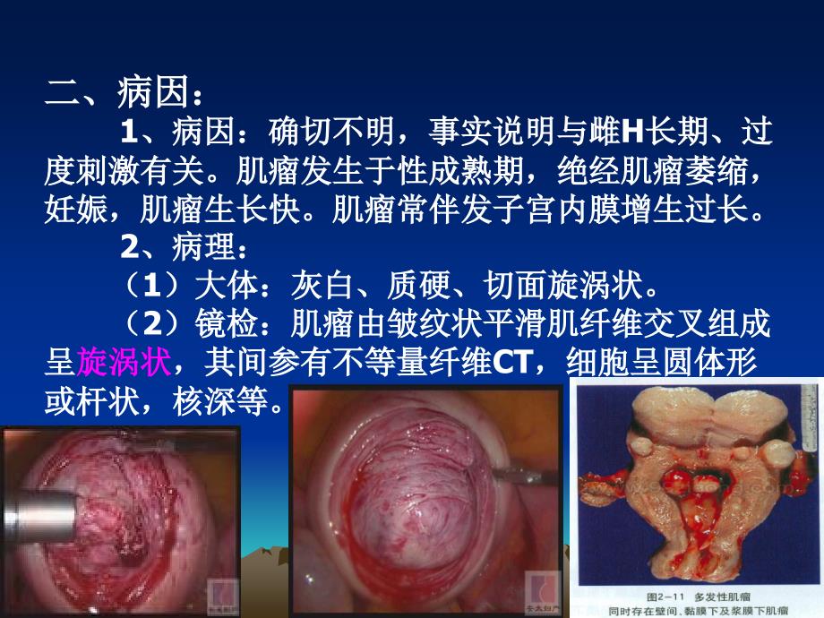 金艳子宫肌瘤_第3页