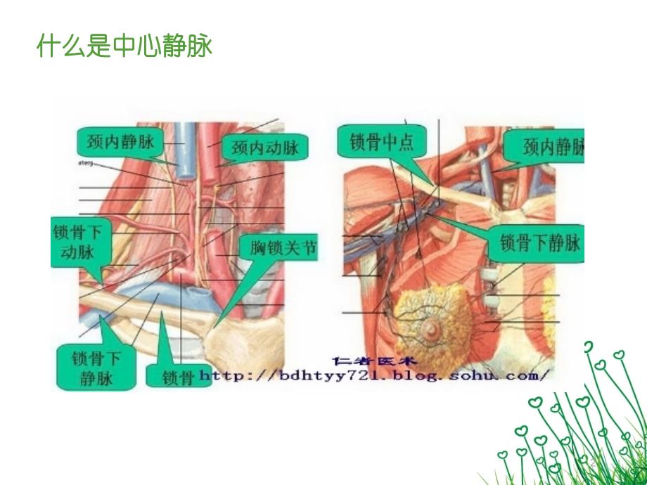 （参考课件）中心静脉置管护理和拔管窘迫综合征.ppt_第2页