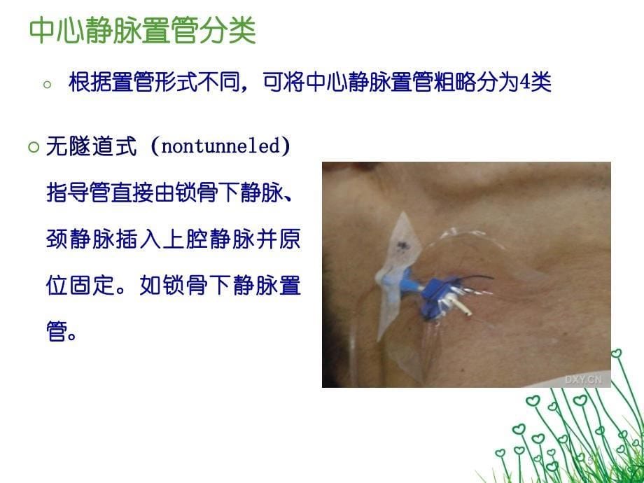 （参考课件）中心静脉置管护理和拔管窘迫综合征.ppt_第5页