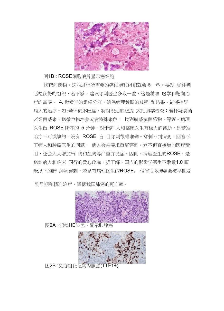 肺癌早筛和精准诊断离不开病理医生的ROSE（玫瑰）_第3页