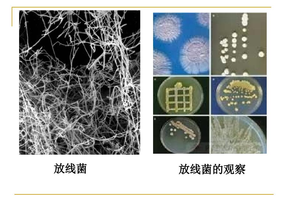 实验五放线菌霉菌的形态观察_第4页