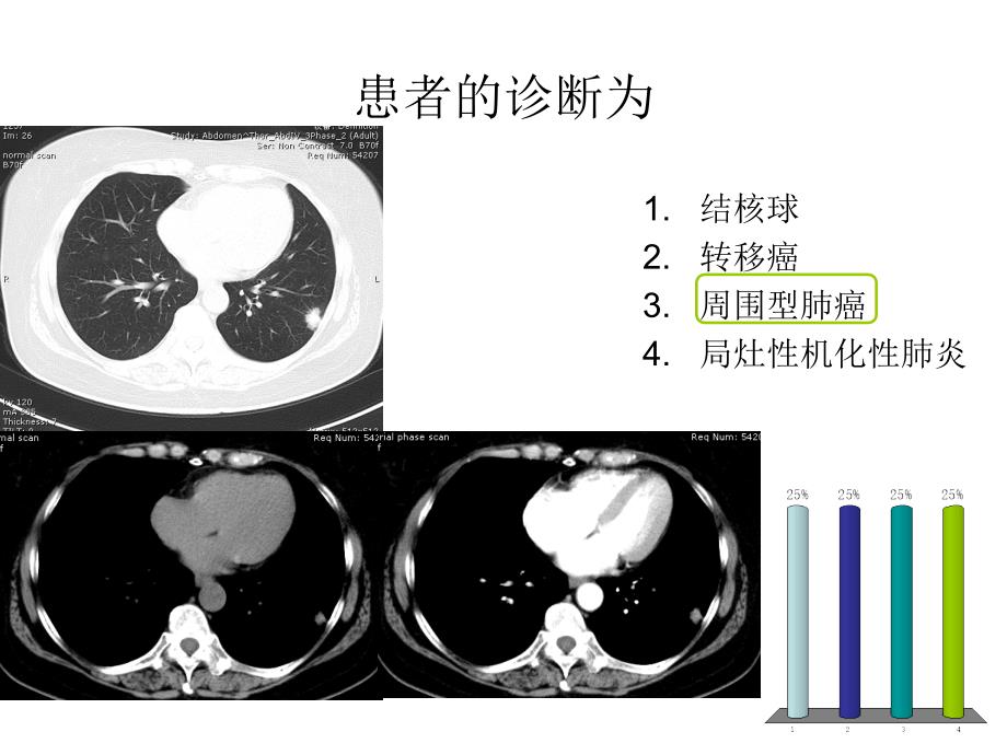 医学影像学课件：呼吸系统肿瘤及纵膈病变-答题器_第3页