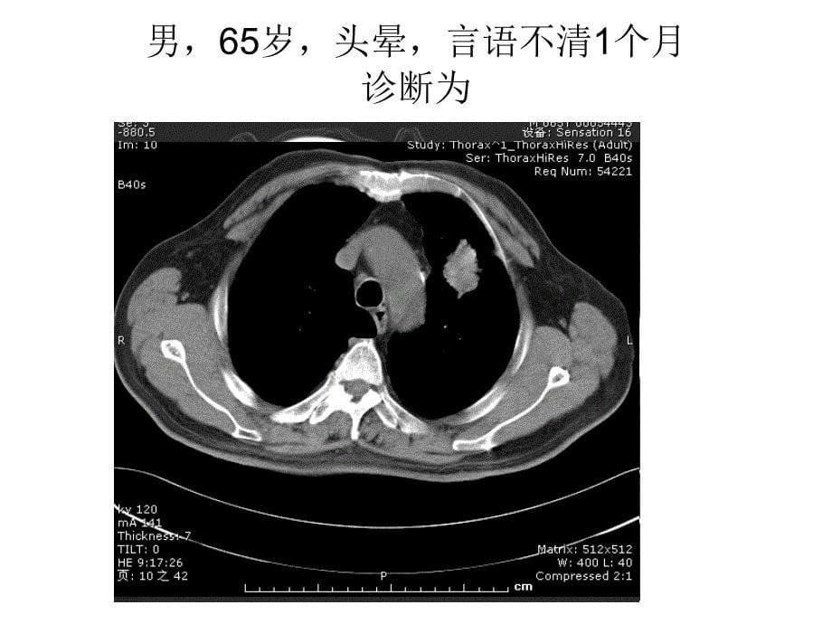 医学影像学课件：呼吸系统肿瘤及纵膈病变-答题器_第5页