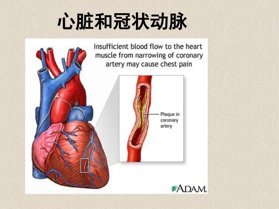 最新冠心病及其防治主题讲座课件_第3页