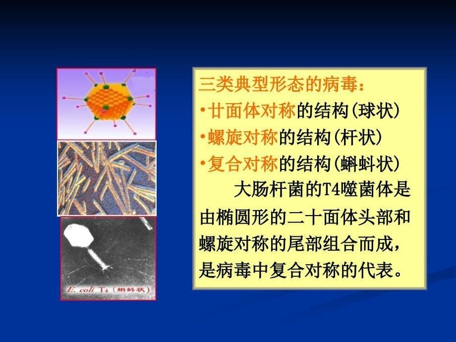 微生物主要类群及其形态结构病毒_第5页